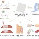 패치 붙이면 줄기세포 스며든다..주사 대체 기술 개발 이미지