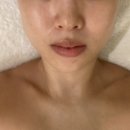 에스브이라인뷰티