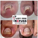 레푸스풋풋한리쌤