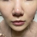 [성분에디터] 머루포도미백앰플 솔직후기 (기미잡티관리, 비타민C앰플)