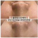 스마일쏠라 | 안산 피부관리 전문점 [쏠라잇스킨케어] - 피부가 반짝반짝!!