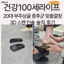 건강100세라이프 | 건강100세라이프 20대 부주상골 증후군 맞춤깔창 3D 스캔 인솔 솔직 후기