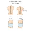 [공지] 동탄필라테스 반송동필라테스 동탄척추측만 로더필라테스 슈로스 척추측만 콥각도 감소 후기