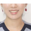 연세인치과의원 네이버블로그