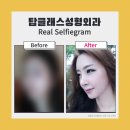 탑클래스성형외과의원 이미지