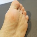 의정부동 피부관리샵 고경피부관리 발각질제거 후기 :) 의정부역피부관리실 추천