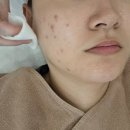 화인화장품 | 부산여드름피부 전문, 개금 피부관리 박신옥 피부연구소