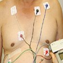 의학과한방(동영상):부정맥 (Cardiac Arrhythmias) 이미지