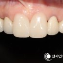 샤인 치과기공소 이미지