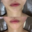 정리수납 테라피 | 군산피부관리 R4U테라피 윤곽관리 후기