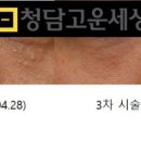 아주고운피부과 이미지