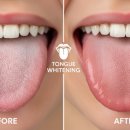 S다인치과의원 | 노르다인 구강유산균 내돈내산 후기 효과 성분 입냄새 제거 효능은?