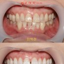 이사랑치과 이미지
