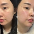 두  메 | 메시엘 PDRN 시카 엑소좀 MTS 앰플 사용 후기