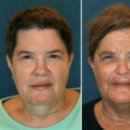 나도 과학실험맨(B) 이미지