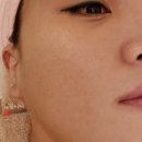 예쁠래에스테틱 이미지