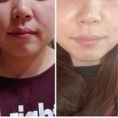 인셀덤 이래서 인셀덤인셀덤 하는구나 부스터세럼리얼후기