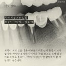 샘케이스