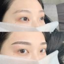 닥터브로우 이미지