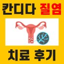 치즈냉 칸디다질염 진해 예인여성병원 예인산부인과 다녀온 후기