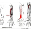 Flexor Pollicis Longus - Hand ( 손의 장무지굴근) 이미지