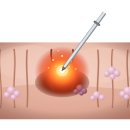모티바 | 모티바프리저베 후기? 사실 90%는 중요한 걸 안 알려줍니다.