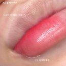 아인메디컬 이미지