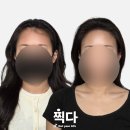 헤어라인문신 내돈내산 후기, 직장인인데 이제 너무나 편해요!