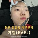 이벨 | 천안 피부관리 성성동 피부관리 블랙헤드 고민 해결! 이벨(EVEL) 방문 후기