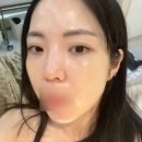 이연 | 김포 구래동 피부관리 이연에스테틱 후기