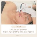 해진메디칼 | 구리갈매 벨로셀에스테틱 관리 후, 4일차에 만족감 100% 크레이지고주파 후기