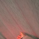 경희정담한의원 | 하남시 한의원-테니스(골프)엘보 봉침, 부항, 테이핑으로 치료