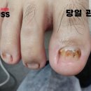 레푸스 사상점 이미지