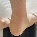 닥터페디매료네일