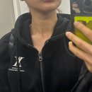 휴젤 | 대치동피부과 목주름 스킨부스터 바이리즌 후기(통증, 효과, 가격)