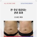 제이미스칼프