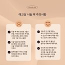 뮤리다(MUURIDA) | 인천 부평 애교살반영구 추천 애교필러 없이 중안부줄이기 내돈내산 찐 후기