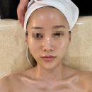신월동165 | 신월동피부관리 비비에스테틱 솔직후기ㅣ3V작은얼굴테라피ㅣ신월동신부관리추천