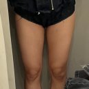 멍크루 | 유라인 지방분해주사 허벅지컷주사 6회차 후기