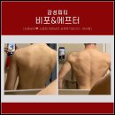 현석메디칼 | 물만골피티 감성피티에서 현석선생님과 멋진 어깨라인 만들기