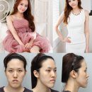 렛미인피부 이미지