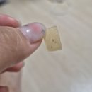 스위스의원 | 💸시술리뷰ㅣ수원역 스위스의원 루비레이저 후기ㅣ시술후사진첨부 ㅣ내돈내산‼️