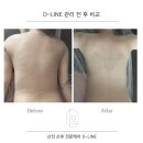 산모체형연구소 네이버블로그