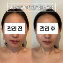 유토피아빌딩 | 대전 윤곽관리 에스테티아 비대칭 이중턱 관리 솔직후기