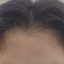 유고이파크 | 에이 마곡나루점&#34;에서 곱슬머리에 효과좋은 제로케라틴 엔젤링 복구매직클리닉 받은 후기!(탈색모도 가능)