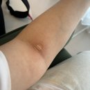 청구제일내과의원 | 아산 삼성미즈병원에서 임당재검하기/임당재검수치 / 이수내과 임당 예약하기