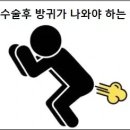 맹장수술후 방귀가 나와야 하는 이유 이미지