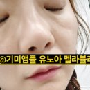 한나스킨케어 - 달서구 | 기미 미백이 고민이시라면 유노아 멜라블러기미앰플 추천 찐후기by에코한나