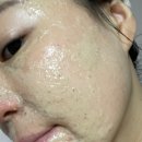 지성소프트 | 저자극 바디스크럽 클렌징 팩까지 가능한 에가톳 소프트 스크럽