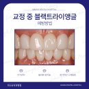 미니쉬치과기공소 이미지